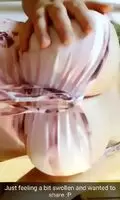 Swollen milky tits