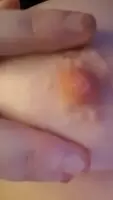Want some?