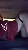 Lordosis