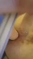 Gaped