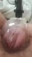 inflates like a balloon